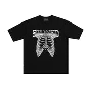 Stoned : Monochrome Ribcage Black